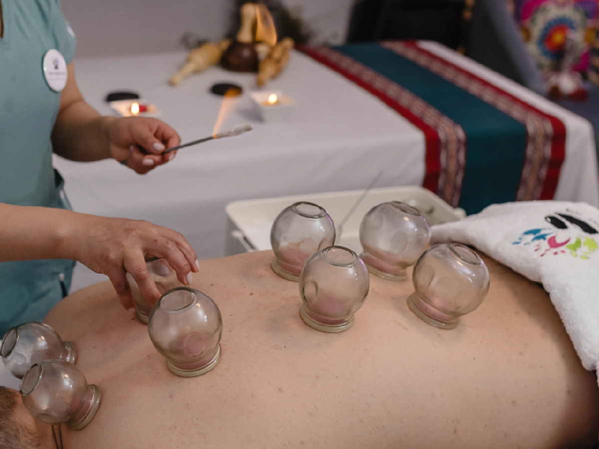 Cupping massage